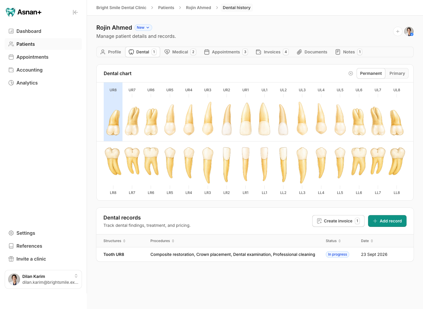 Rojin Ahmed's Permanent tooth chart and Dental records table in the fictional Bright Smile Dental Clinic.