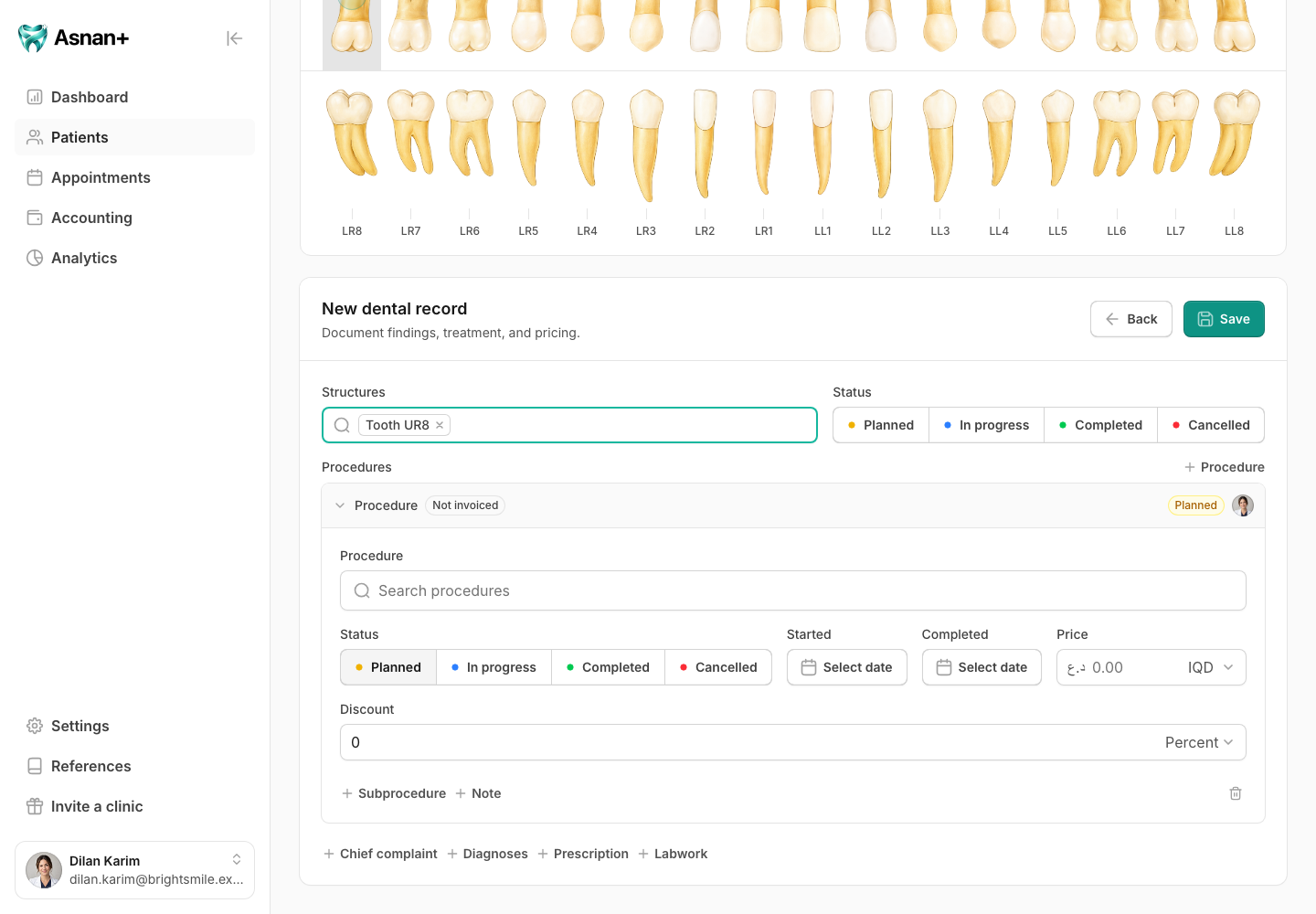 A new dental record for a fictional patient with one tooth selected and a planned status.